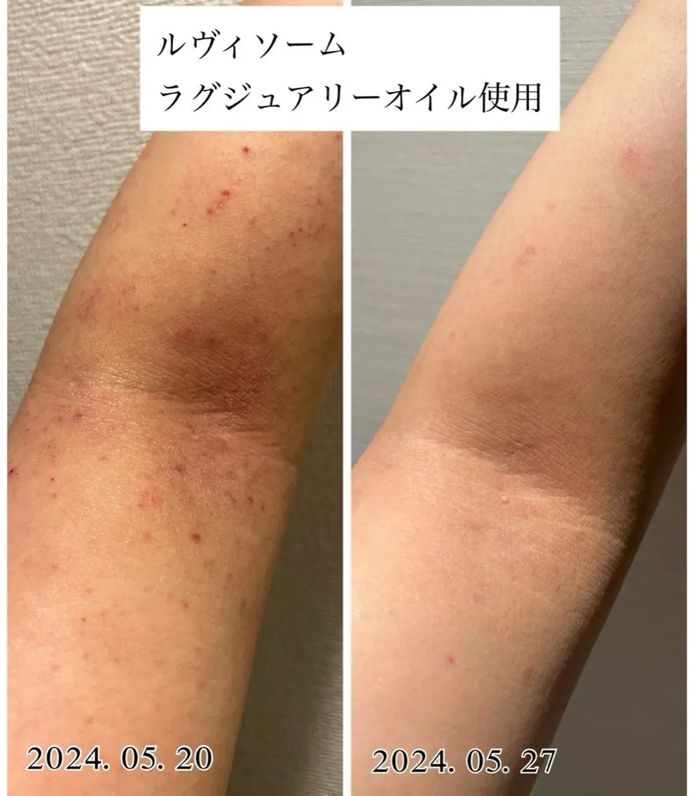 肌管理専門店 mebell天王寺店のエステ・リラクイメージ