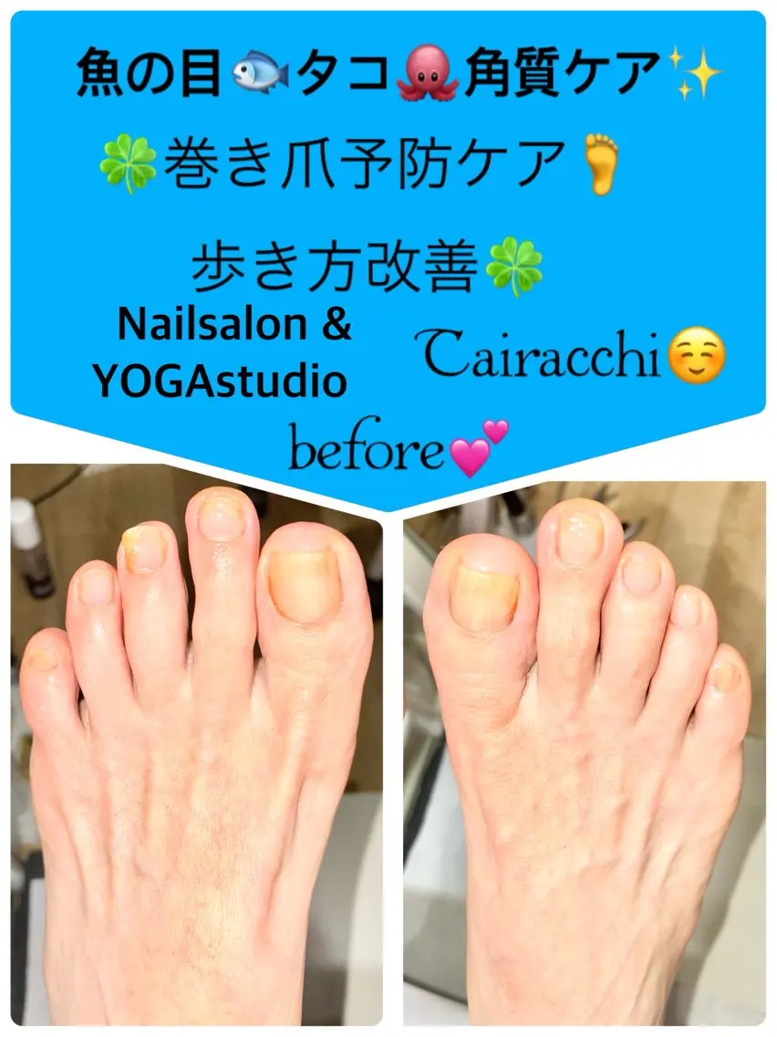 ネイル フットネイル フットネイル Tairacchi ﾀｲﾗｯﾁのエステ・リラクイメージ