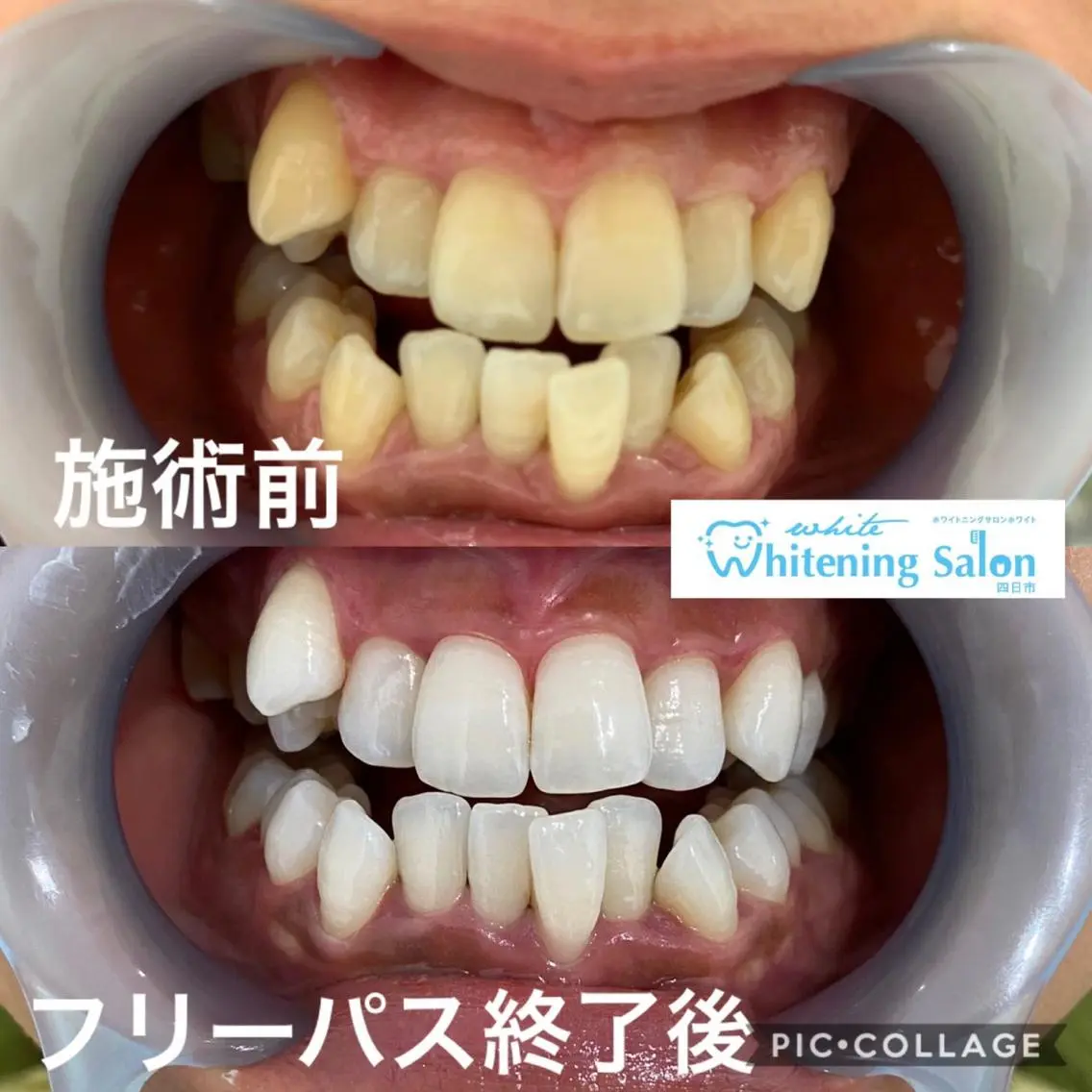 アイラッシュ ホワイトニング四日市のマツエク・マツパデザイン