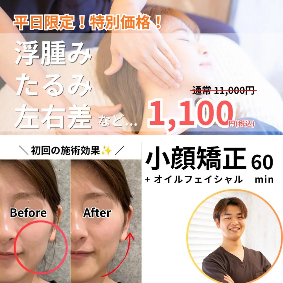 初回平日限定1,100円!《小顔矯正/90%off❗️》フェイスライン/むくみ/たるみ/左右差/リンパ/エラの写真