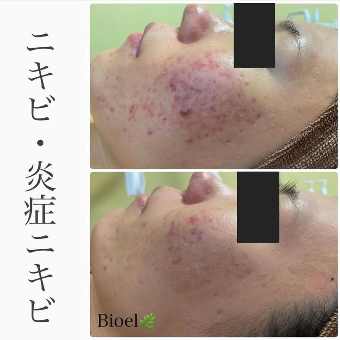 エステ ハーブピーリング専門 BIOPLUS+川崎のエステ・リラクイメージ