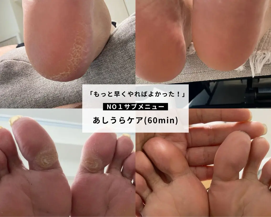 Achura エチュラのエステ・リラクイメージ