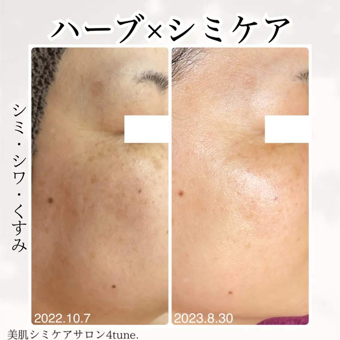 美肌シミケアサロン 4tune.RUMIのその他イメージ