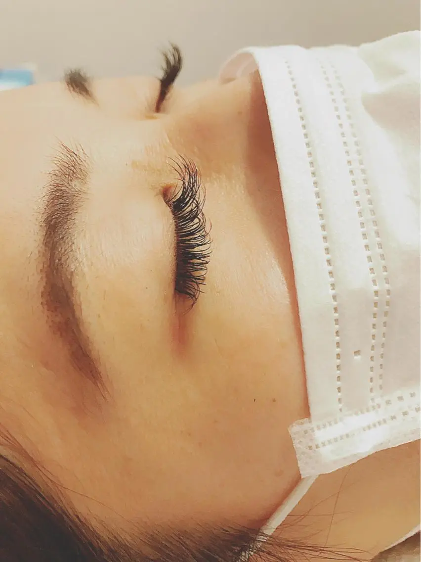 フラットラッシュ100本の写真