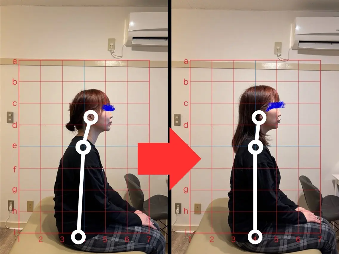 【頑固な痛みや凝りに】こりや痛みに根本から改善する鍼+整体　　　　　　枚方市駅徒歩5分の写真