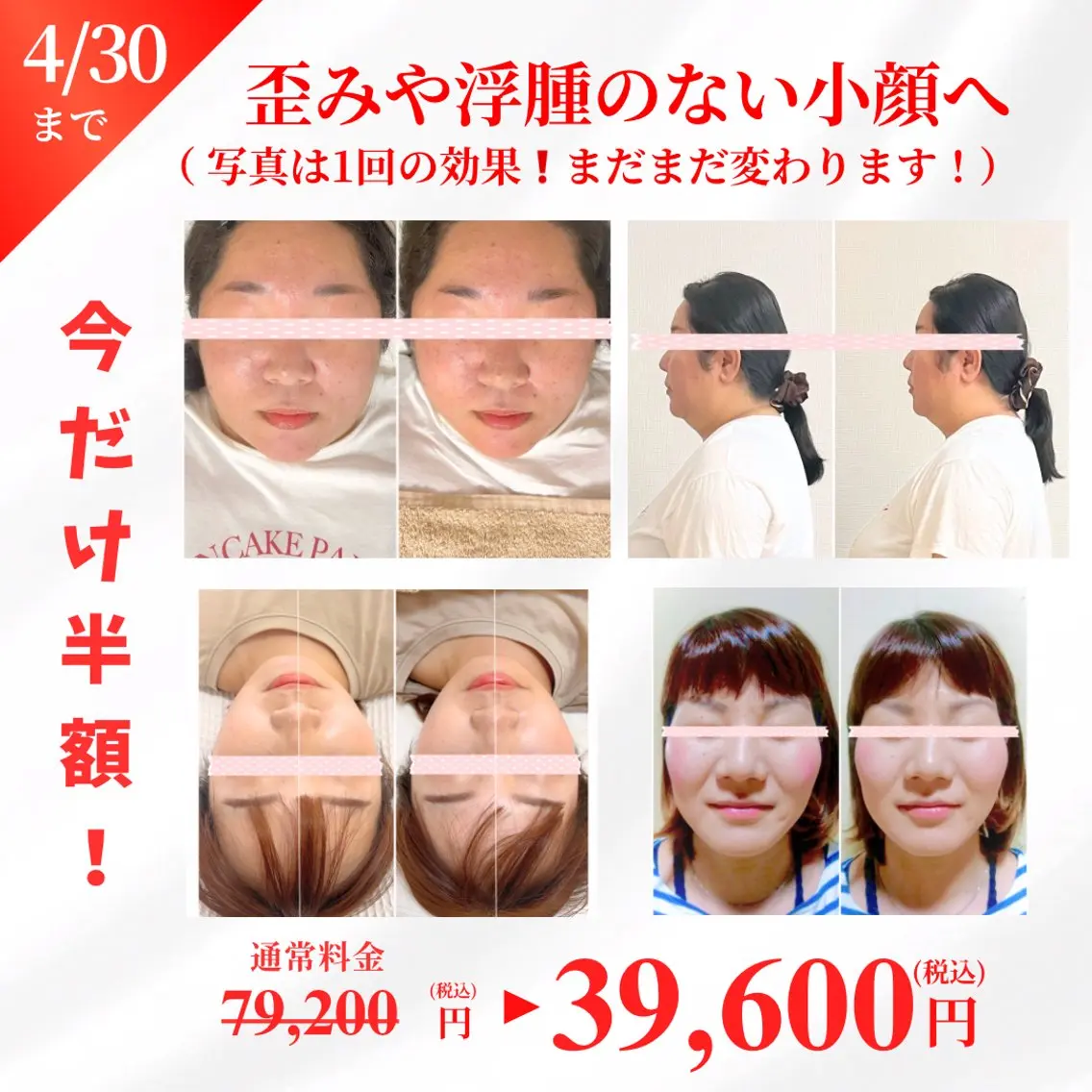 【🈹50%オフ】60分×8回💪お顔＆お身体を同時改善❗️整った小顔⭕️健康的なお身体⭕️結果重視の施術🔥【現金】の写真