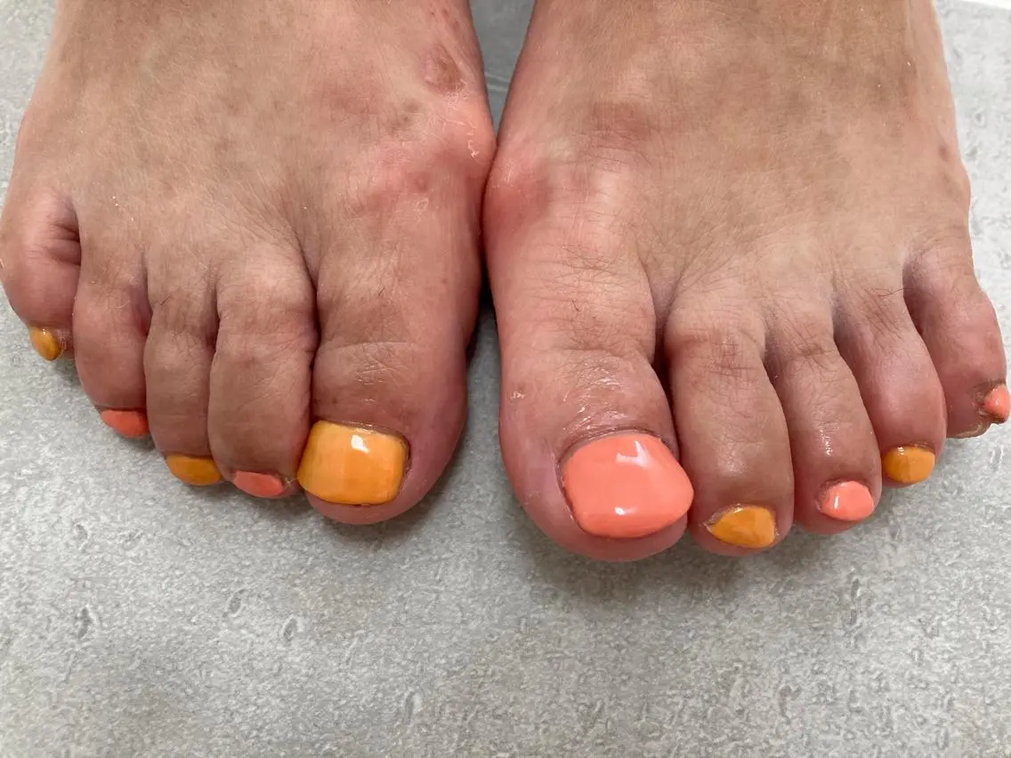 ネイル フットネイル mogunail &blowのネイルデザイン