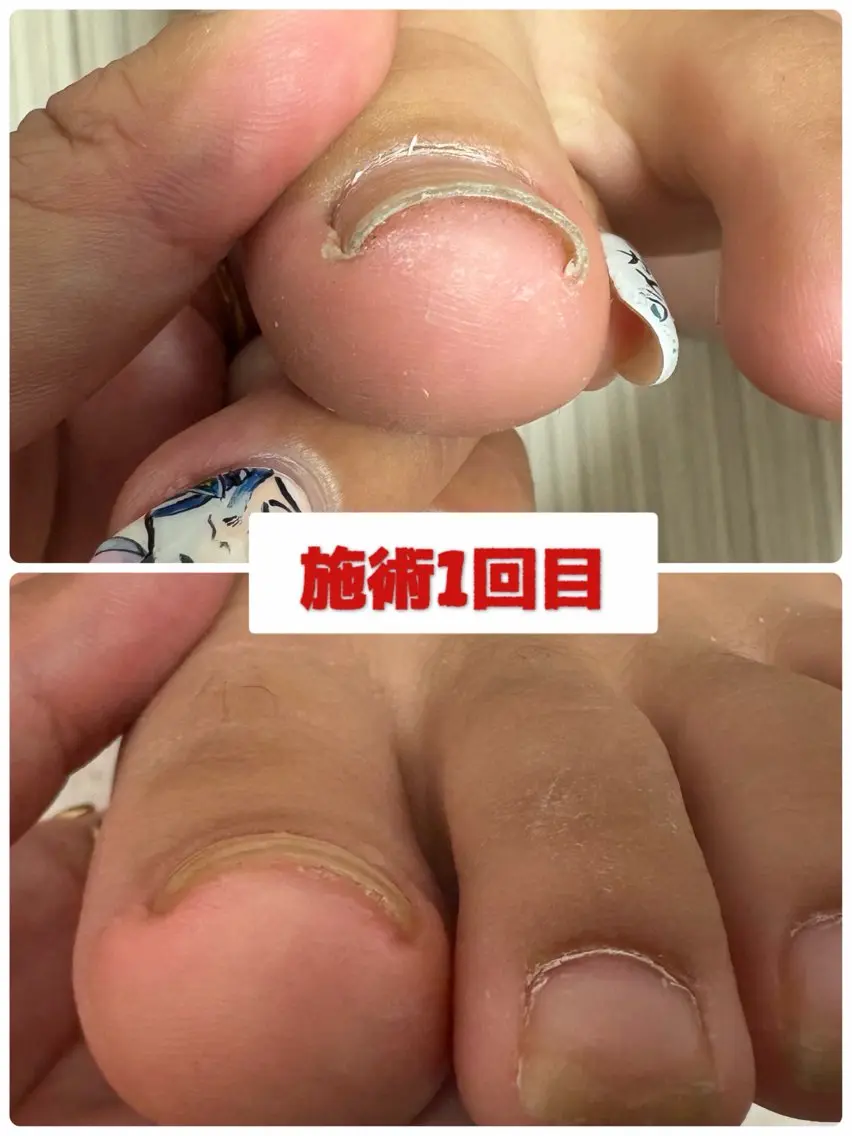 ネイル フットネイル -TOIRO- Eriのネイルデザイン