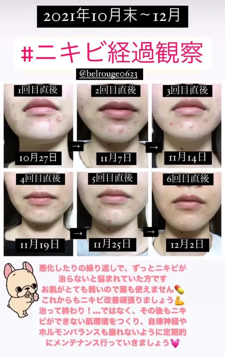 エステ 自由が丘📍 Belrougeのエステ・リラクイメージ