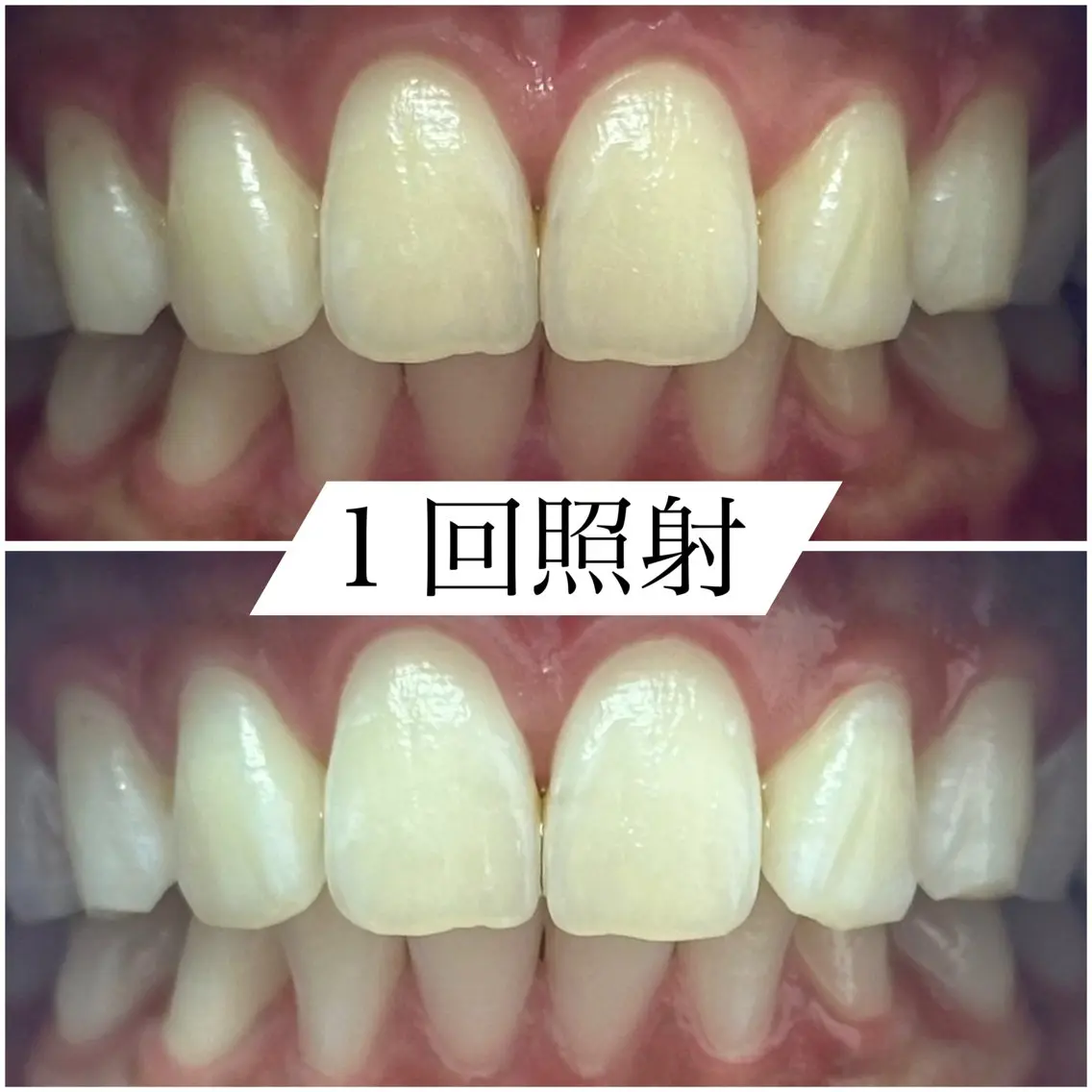その他 White base ホワイトニングサロンのその他イメージ