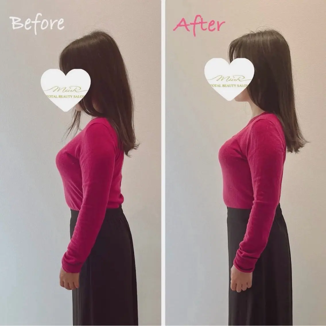 美容整体×痛くない小顔調整 75minの写真