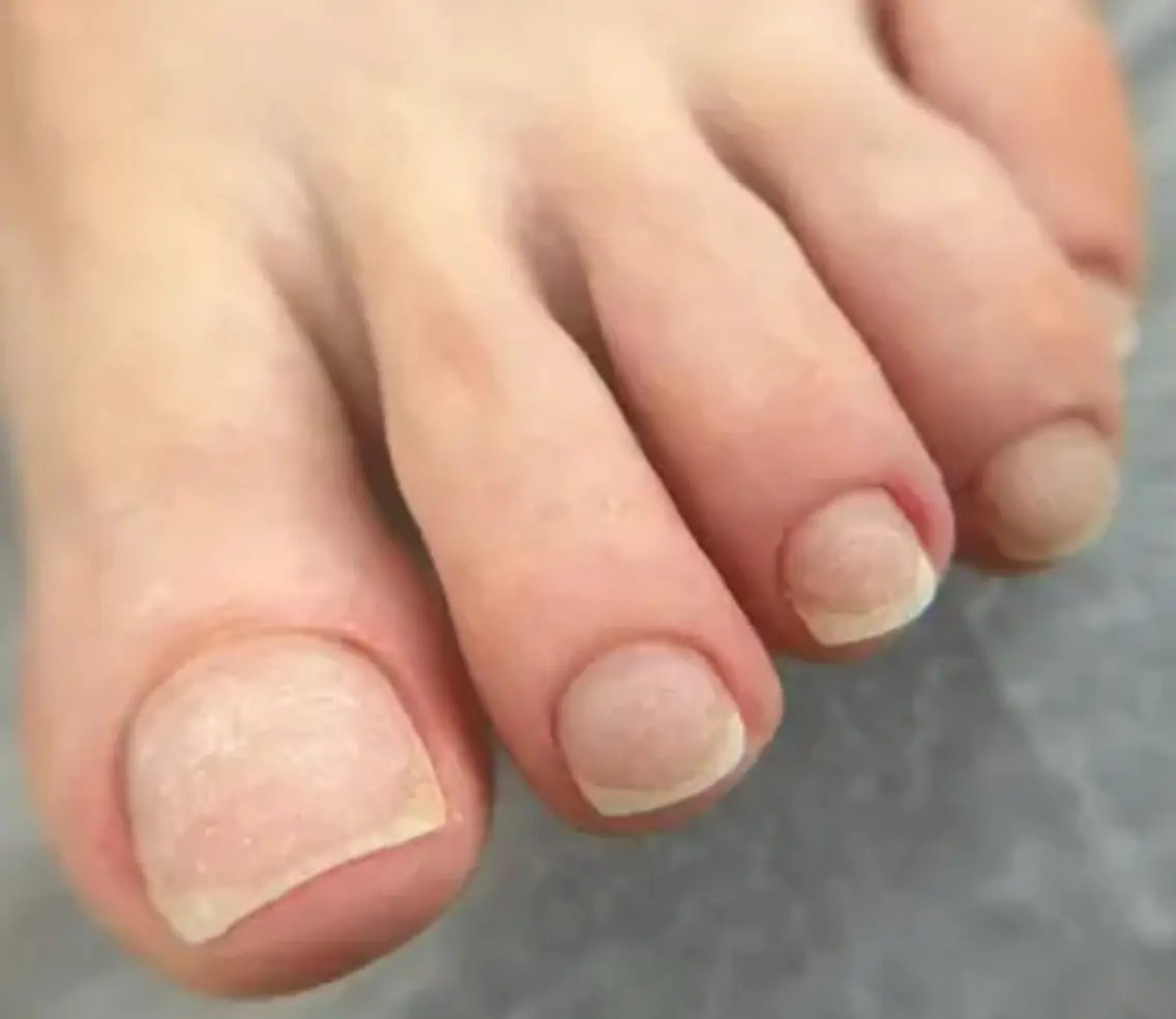 フットケア込み オフのみ 4800の写真