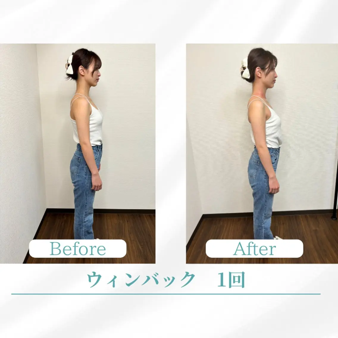 エステ リラク 美容鍼サロン ボディコンディションのエステ・リラクイメージ