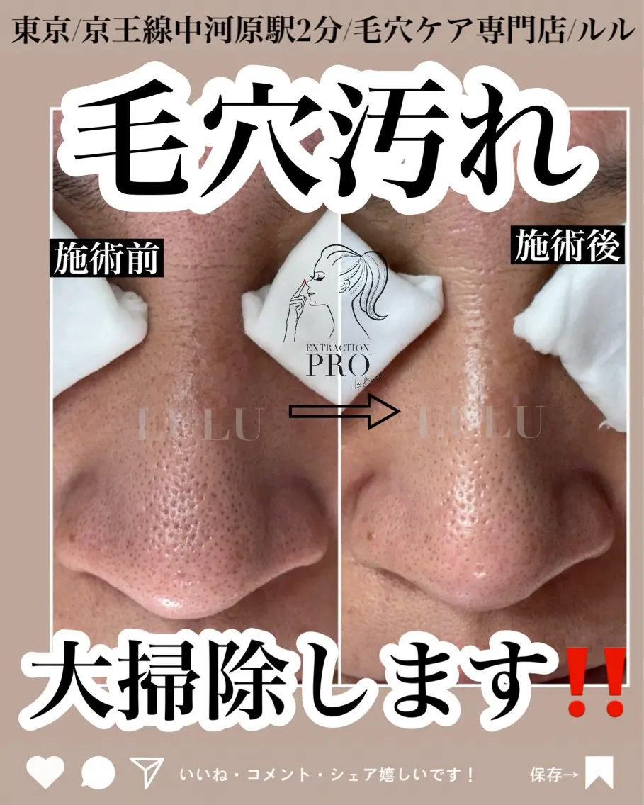 エステ LULU ルルのエステ・リラクイメージ