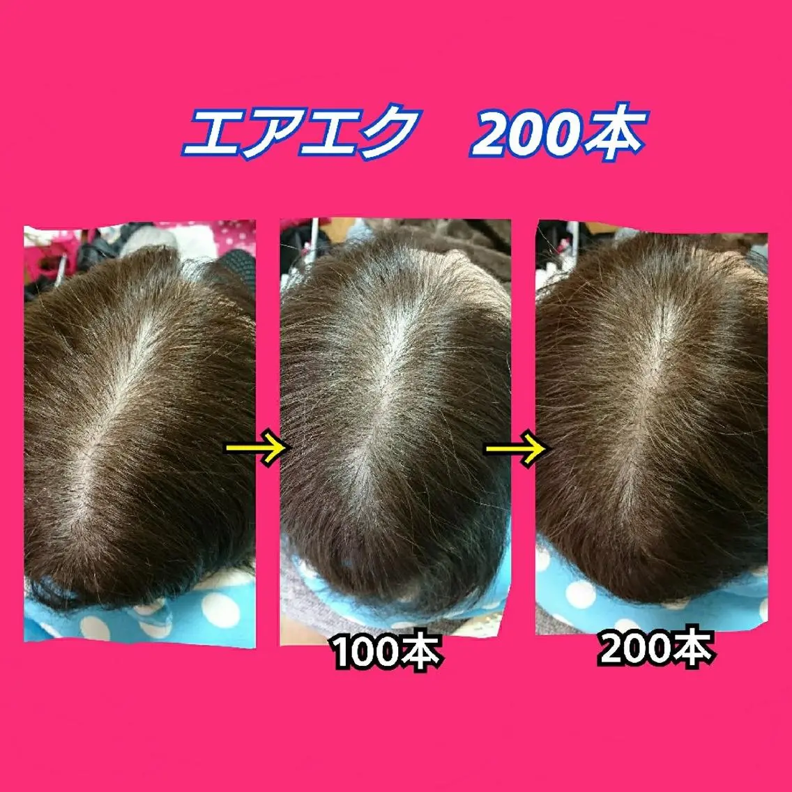 ミディアム ヘアアレンジ エクステ nail yukkoのネイルデザイン