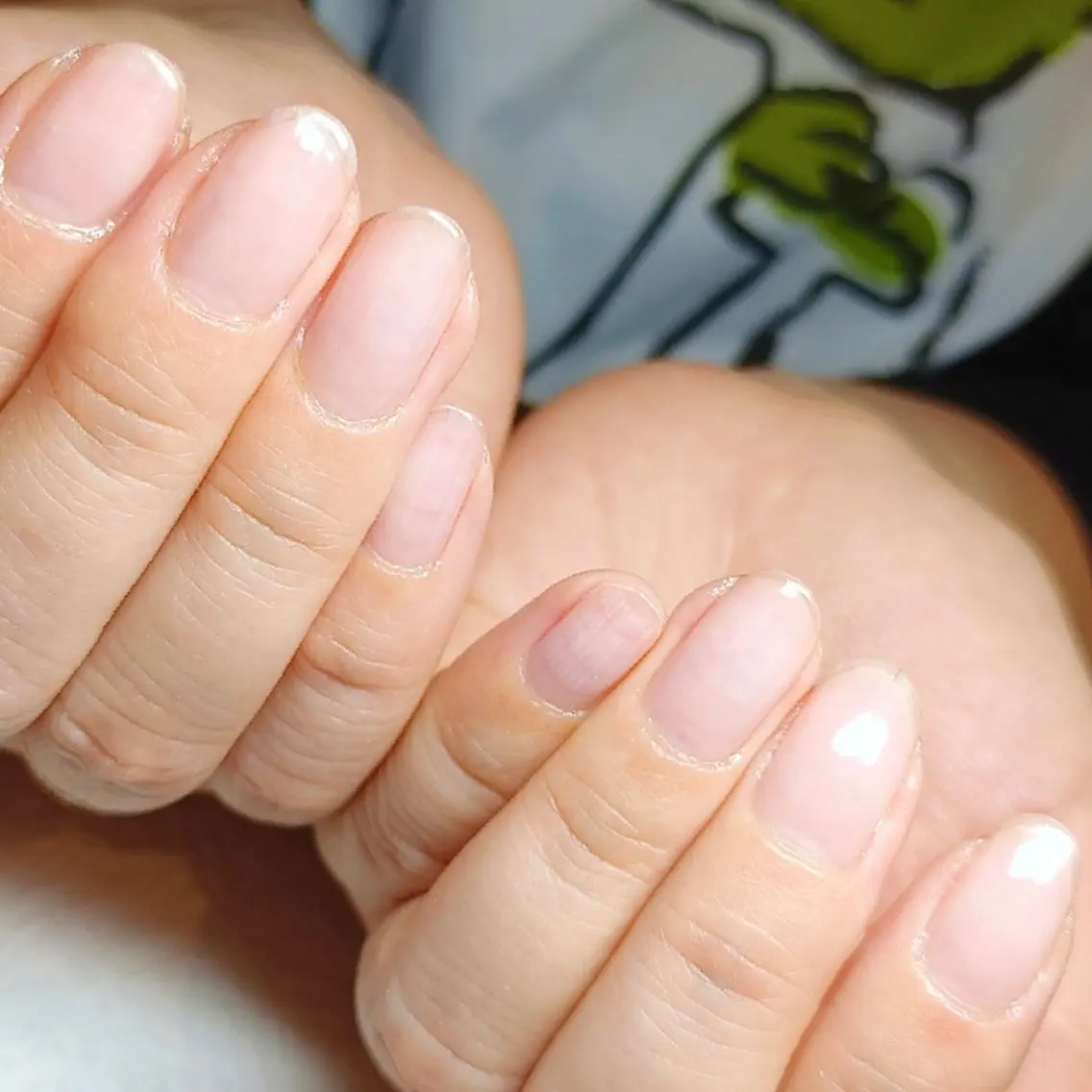 ネイル 氷ネイル・うるうるネイル ハンドネイル ハンドケア 深爪矯正/爪育成ケア manie nailのネイルデザイン