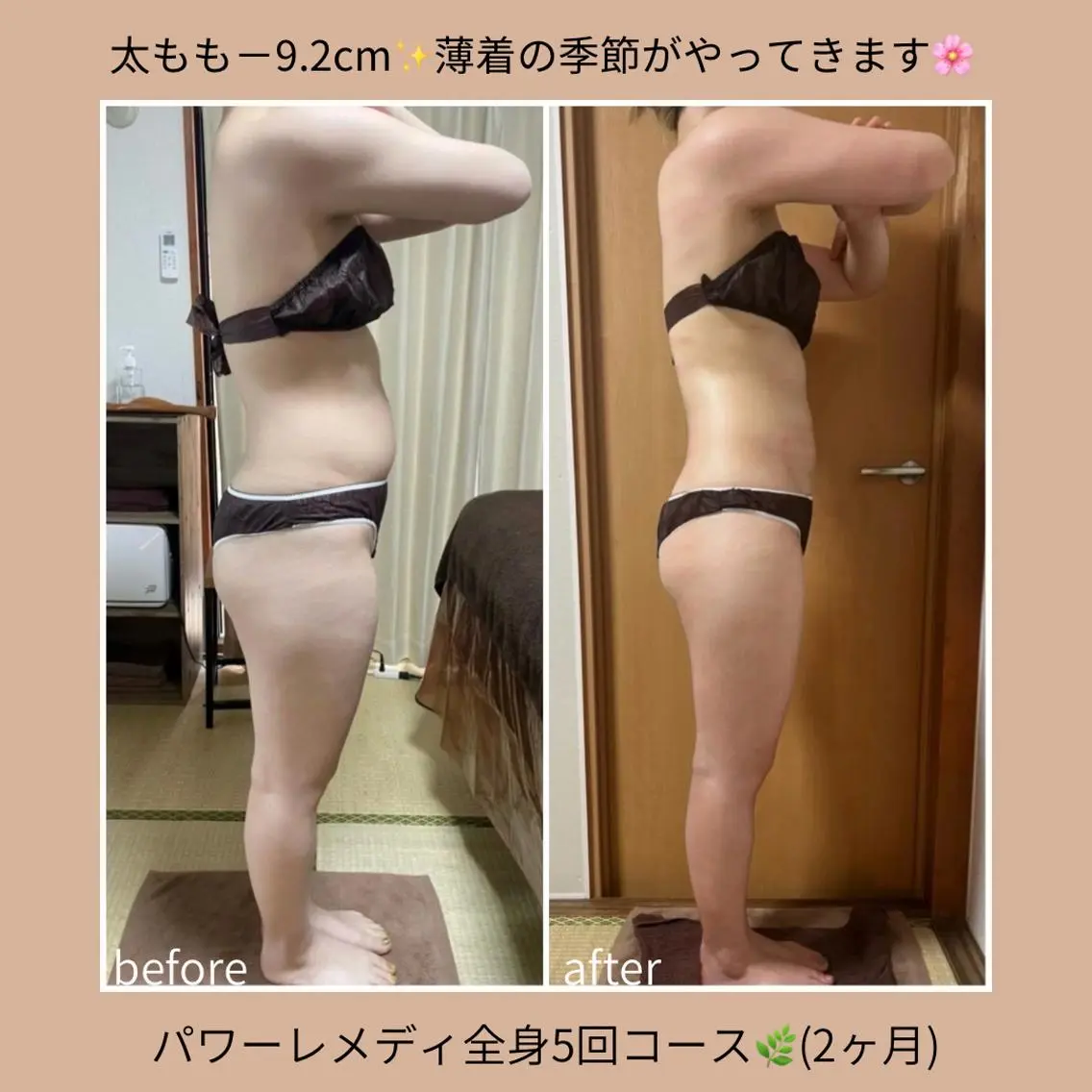 《本気痩せ×疲労改善 》 BILOOPのエステ・リラクイメージ