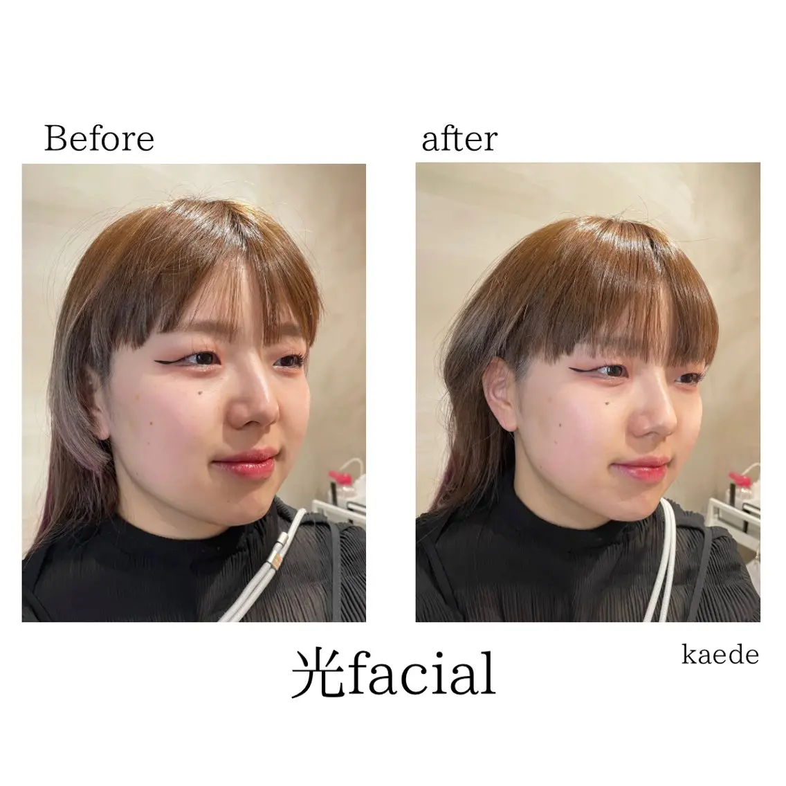 🎀kaede🎀 骨格似合わせ眉毛の眉毛・アイブロウイメージ
