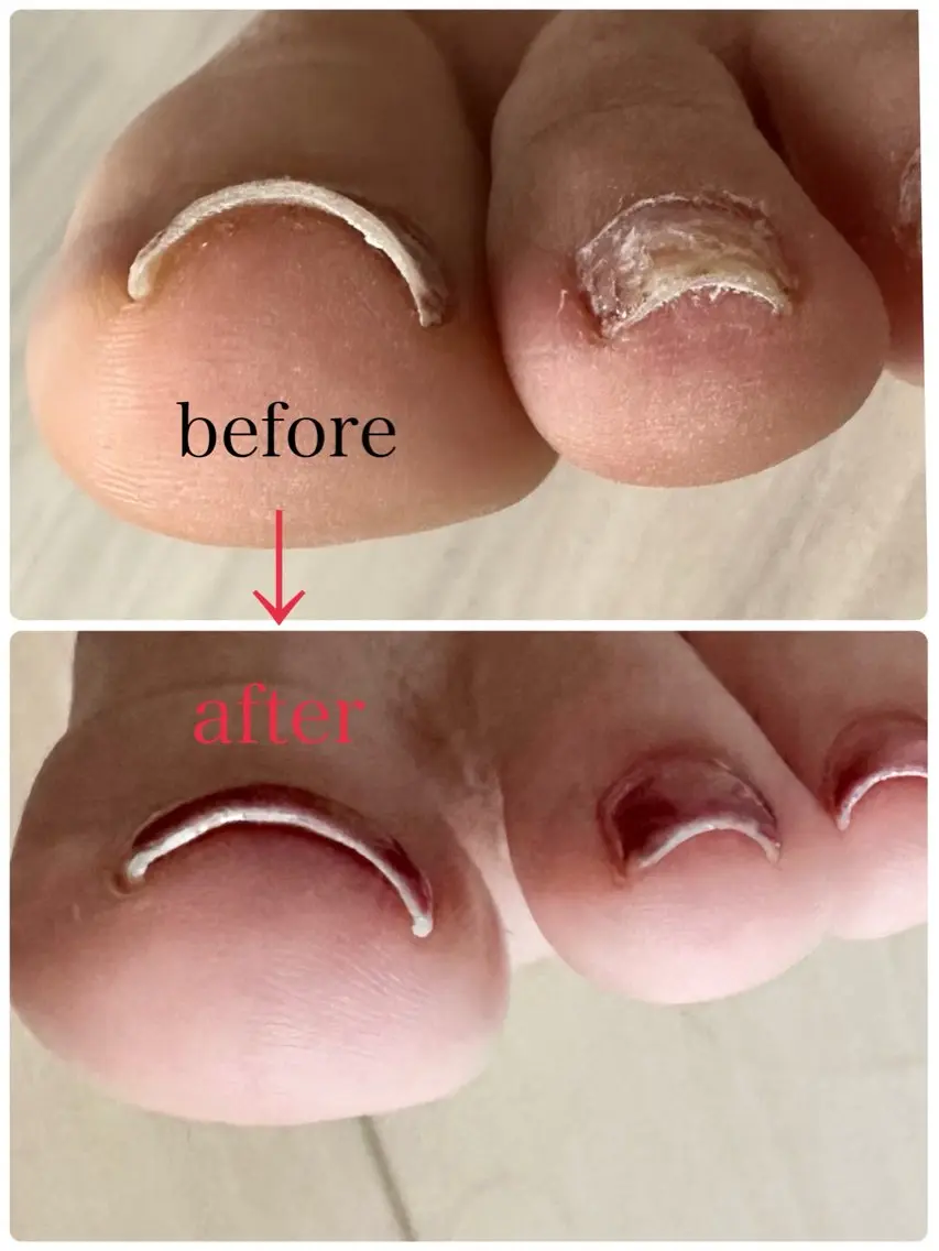 ネイル フットネイル Noa nailのネイルデザイン
