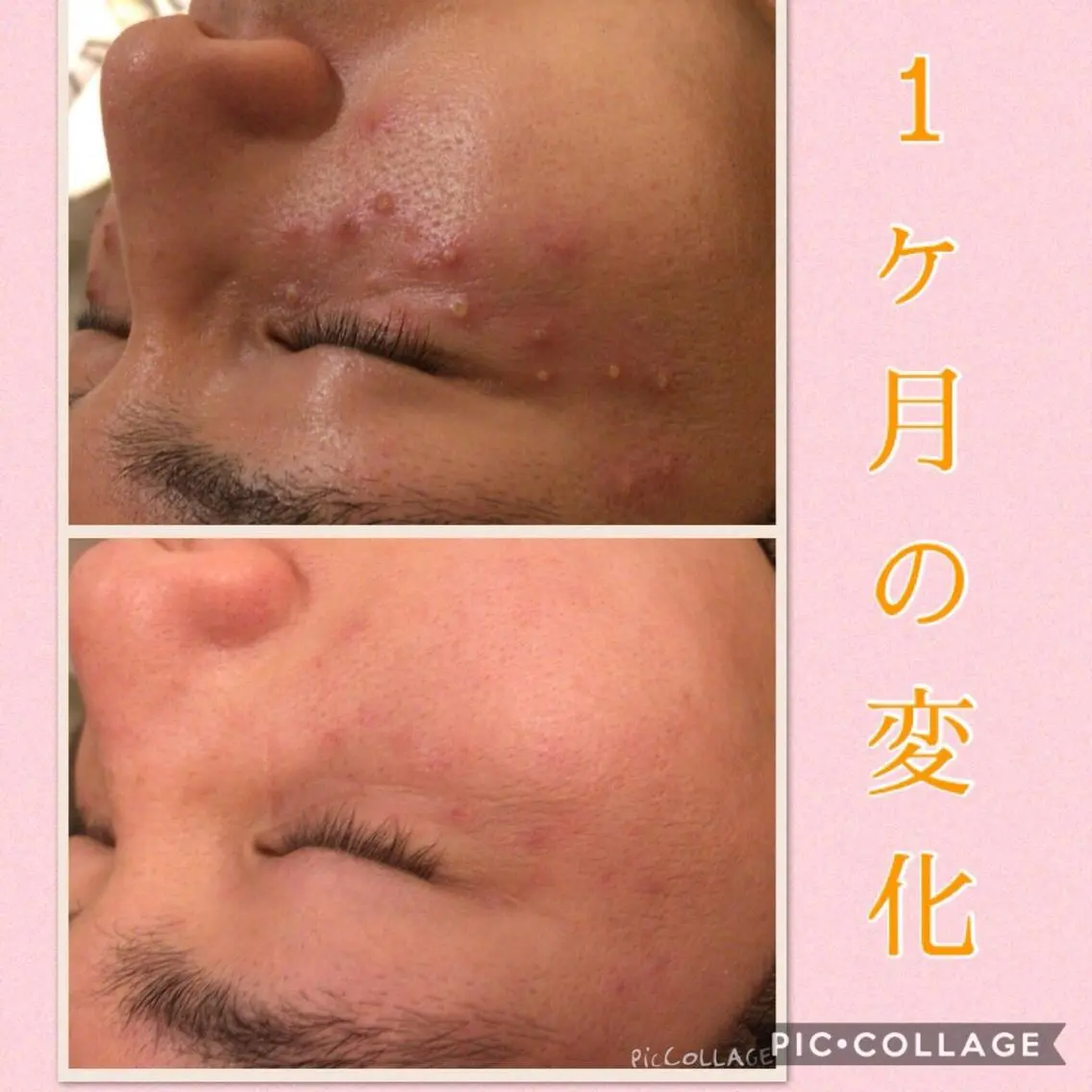 ミディアム カラー パーマ ヘアアレンジ メンズ キッズ ネイル マツエク・マツパ ニキビ・肌質改善専門 ♡人生が変わるサロンのエステ・リラクイメージ
