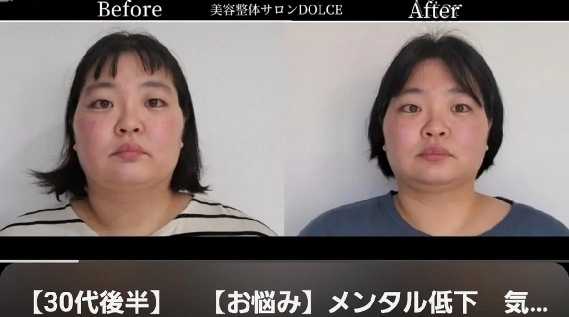 【生理痛からの腰痛】IRT療法の写真