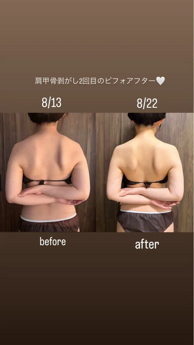 ブライダルオススメ✨ドレスから見える✨背中、二の腕、デコルテ、腰回り、肩甲骨剥がし、巻き肩改善♡の写真
