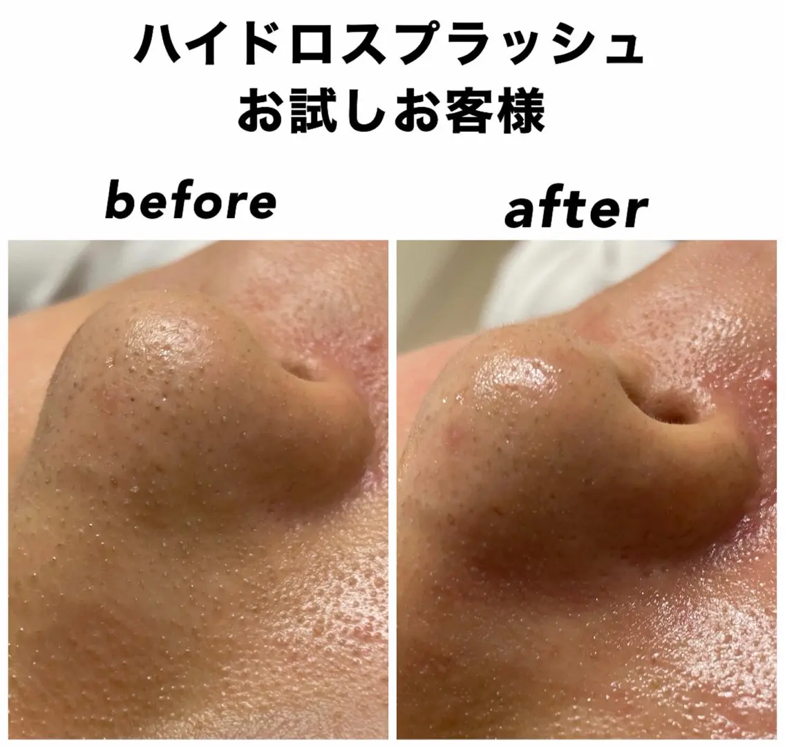 エステ リラク ネイル・エステサロン UILANIのエステ・リラクイメージ
