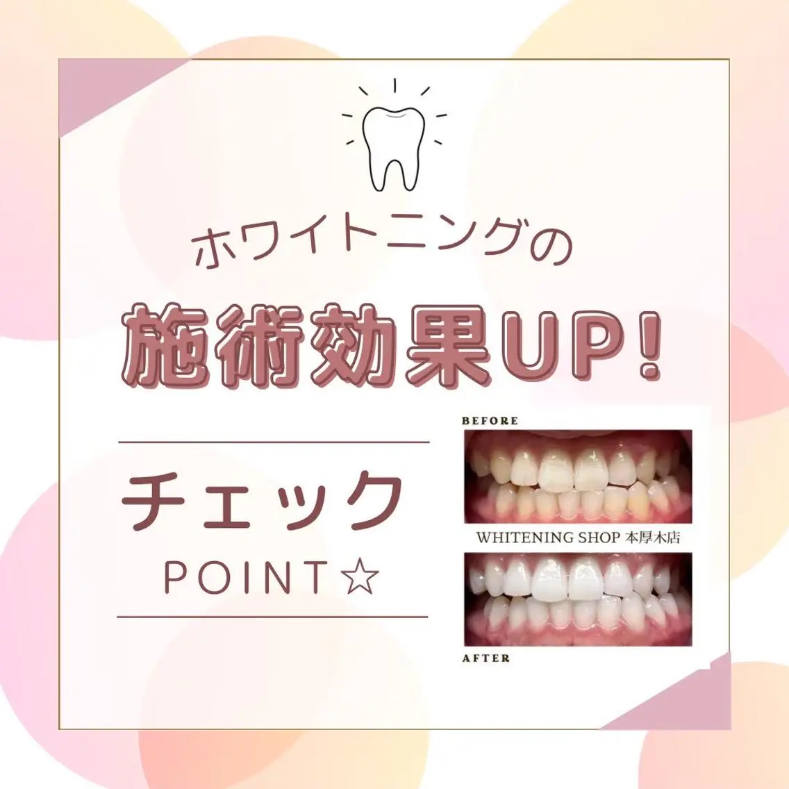 メンズ その他 ホワイトニング ショップ本厚木のその他イメージ