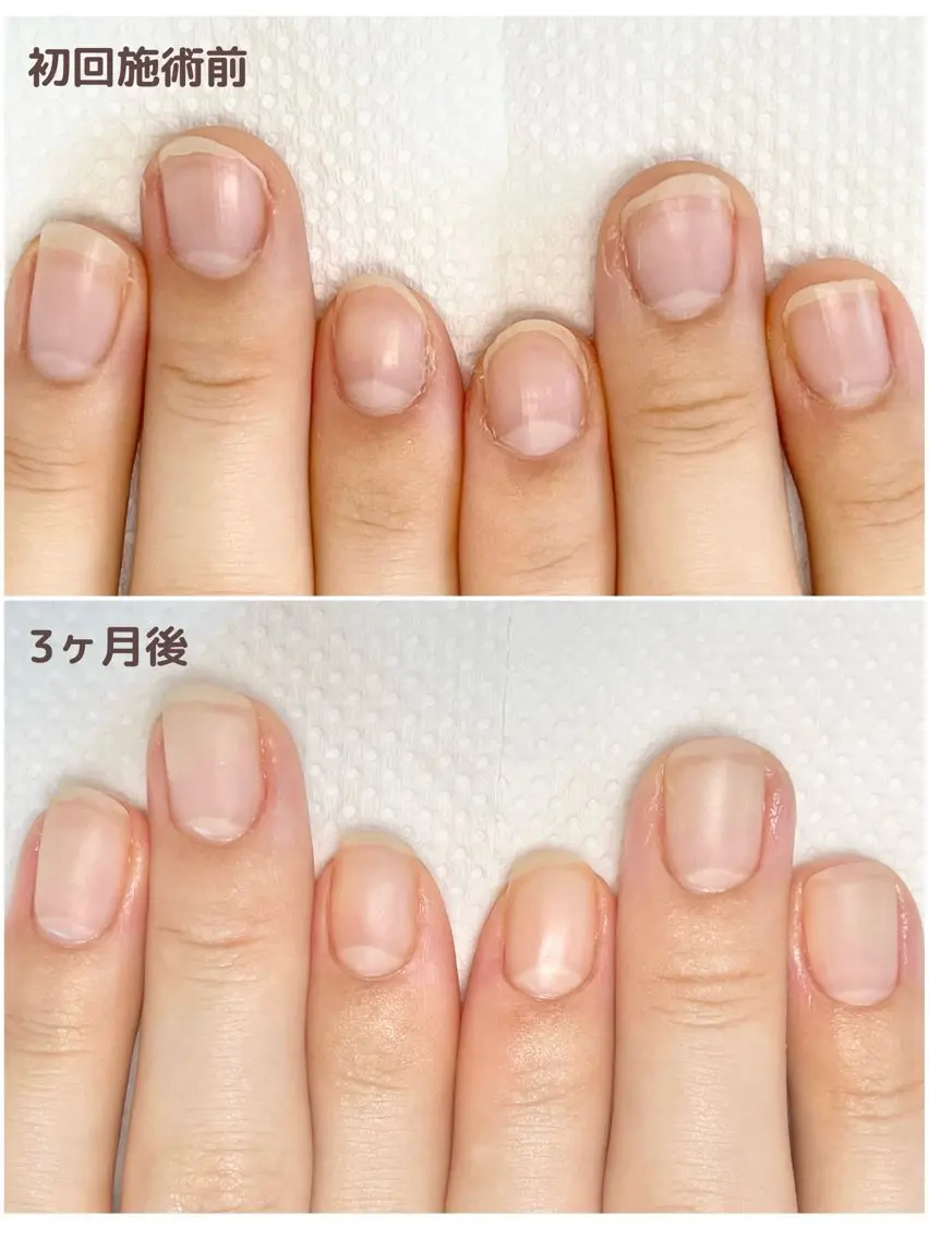 ネイル クリアネイル 井口 みわこのネイルデザイン