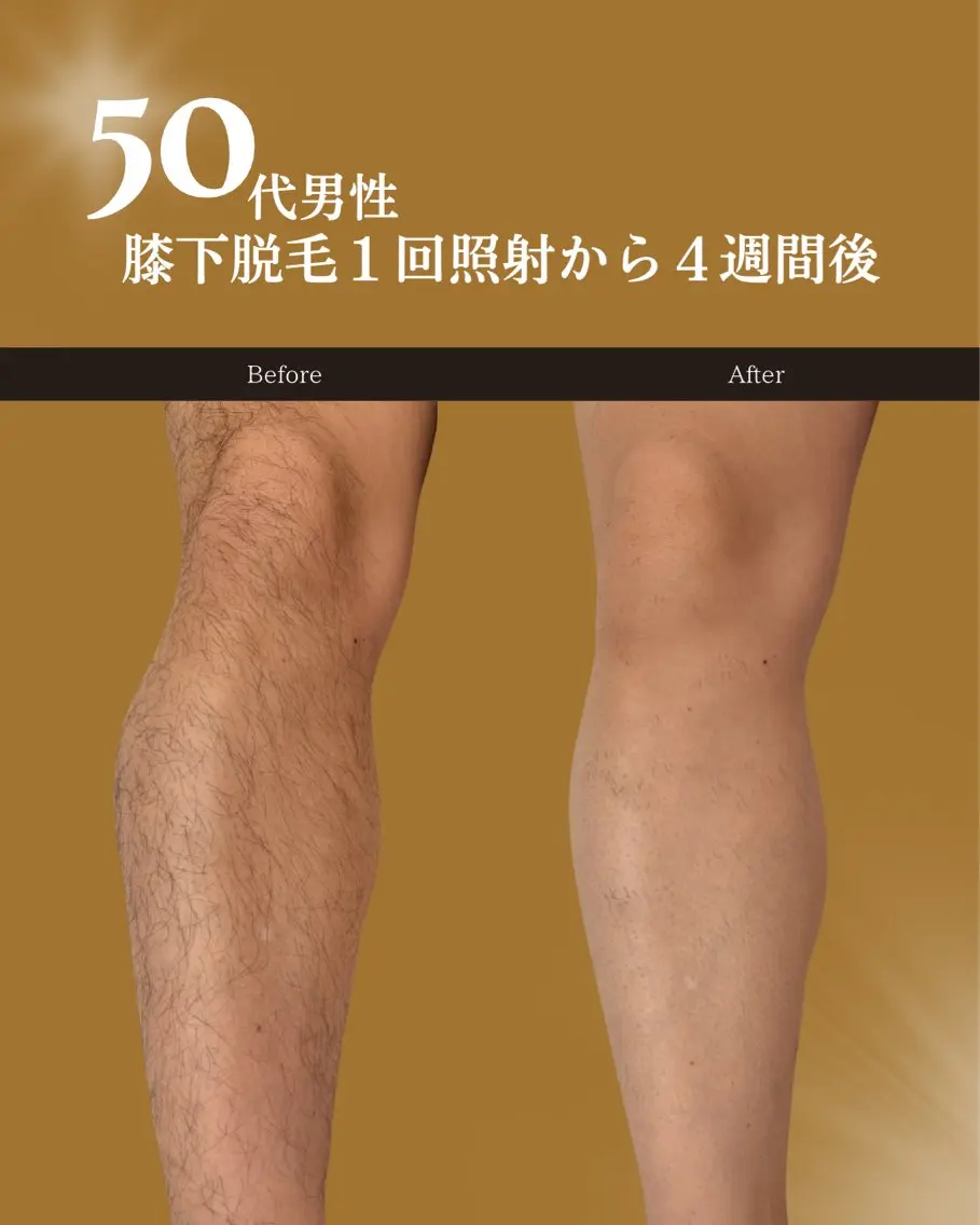 メンズ Maison Ulyssesのエステ・リラクイメージ