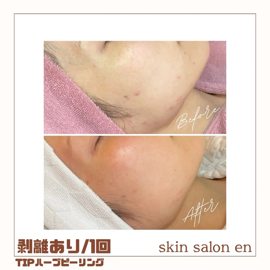 エステ skin salon enのエステ・リラクイメージ