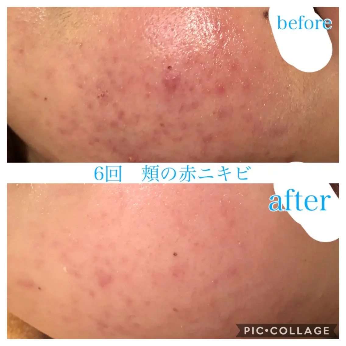 セミロング カラー パーマ ヘアアレンジ メンズ キッズ ネイル マツエク・マツパ エステ リラク EnsorClair 代表 野口真央のエステ・リラクイメージ