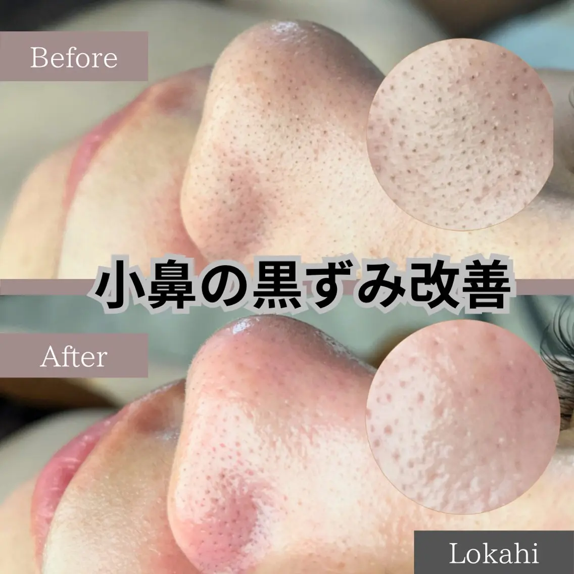 脱毛サロン Lokahiのエステ・リラクイメージ