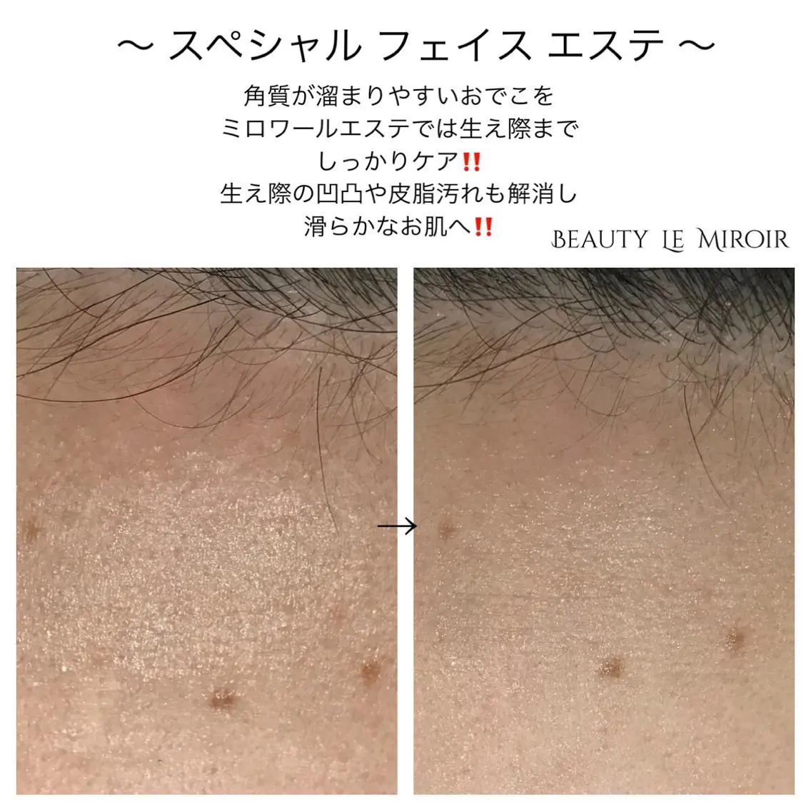 ビューティー ミロワールのエステ・リラクイメージ