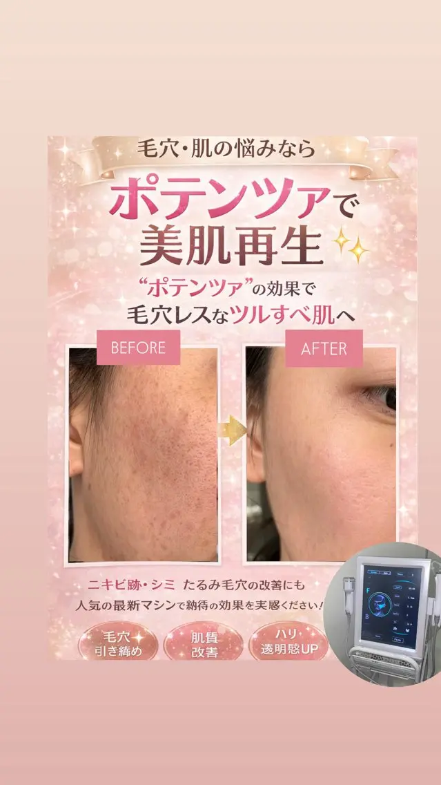 マツエク・マツパ エステ 愛維美水光美肌専門店 メンズレディースokのエステ・リラクイメージ