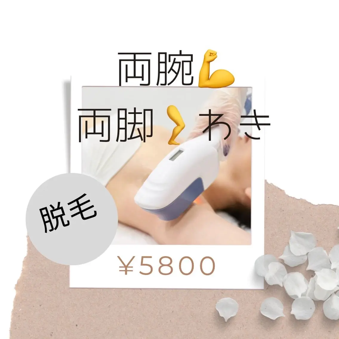 【レディース】脱毛 腕、足、わき ¥5800の写真