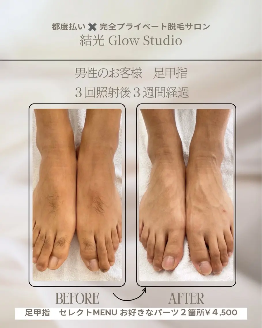 脱毛 結光Glow Studioのエステ・リラクイメージ