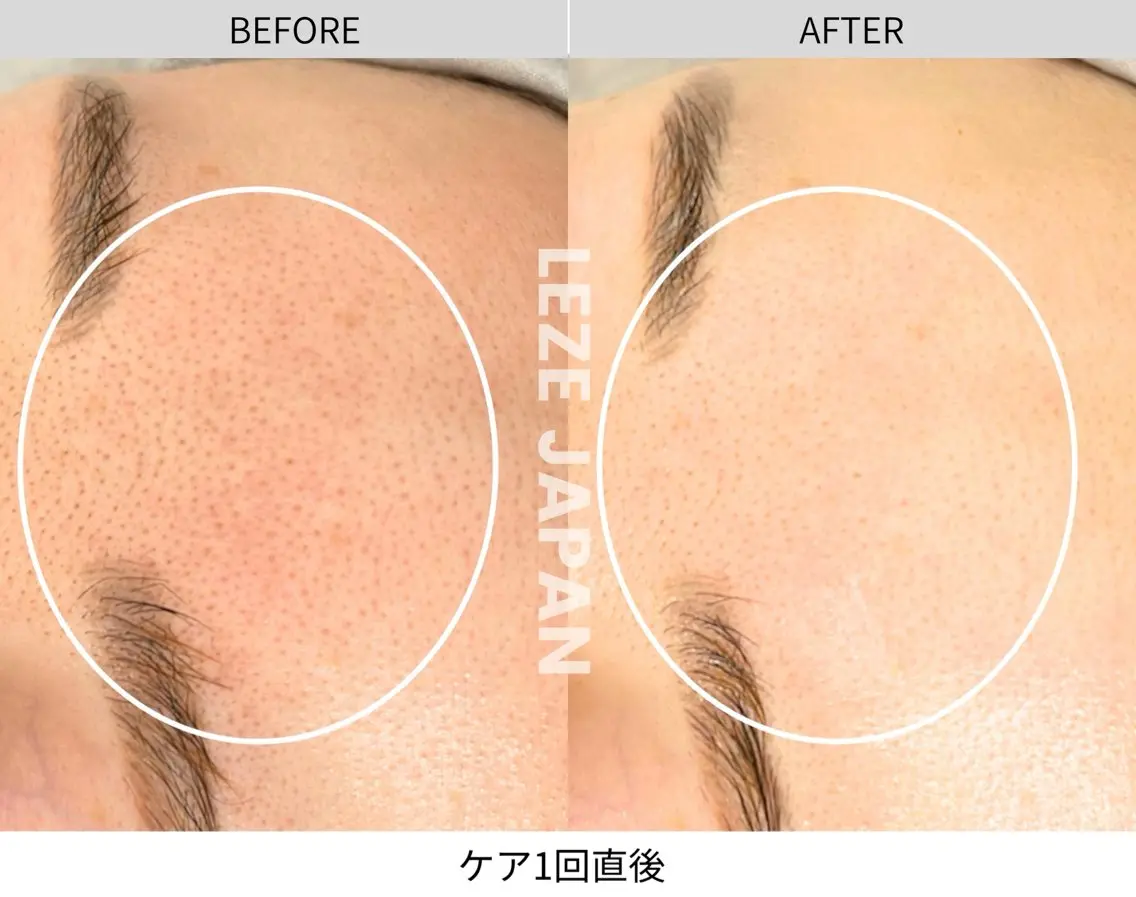 LA CLARTEのエステ・リラクイメージ