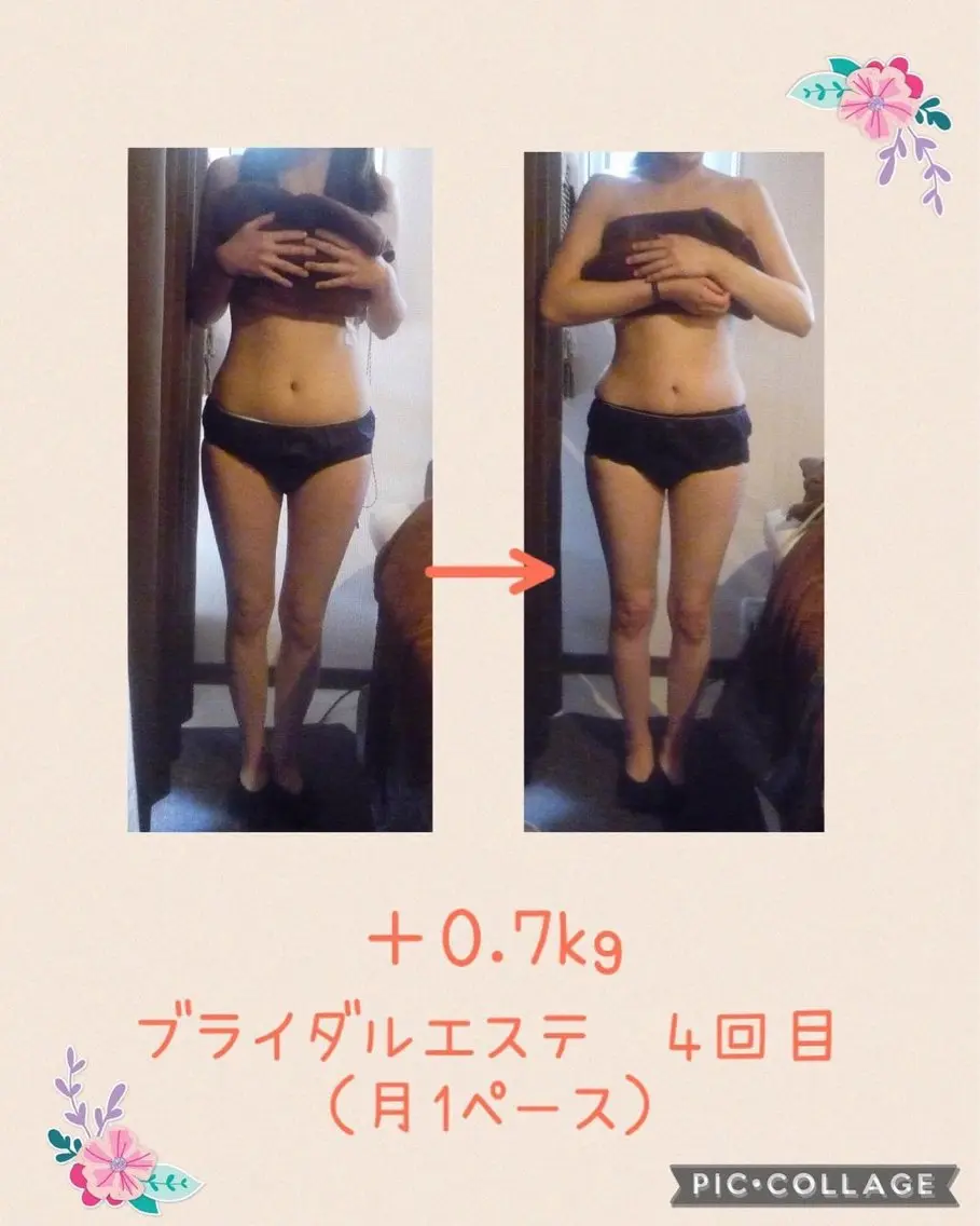 【お試し】ブライダルエステ​〜​上半身集中➕お顔・お首元ホワイトニングフェイシャル​〜​（100分）✨肩甲骨矯正付き✨の写真