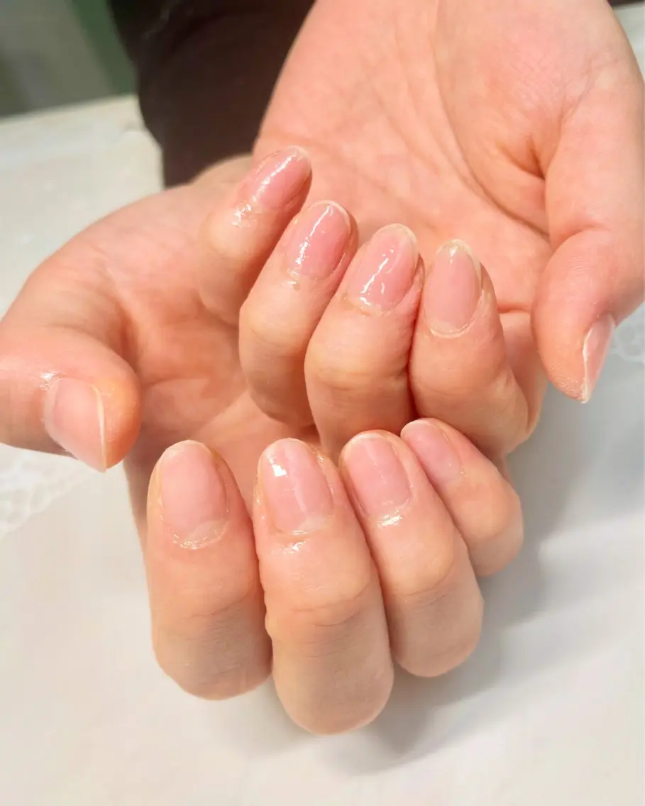 ソフトジェルオフのみ。の写真