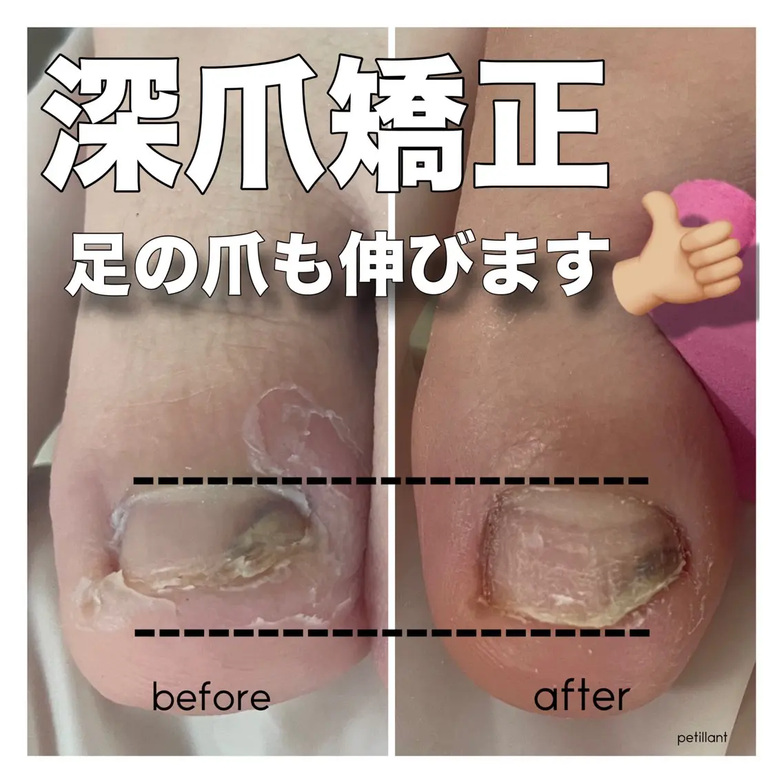 ネイル nail salon petillantのネイルデザイン