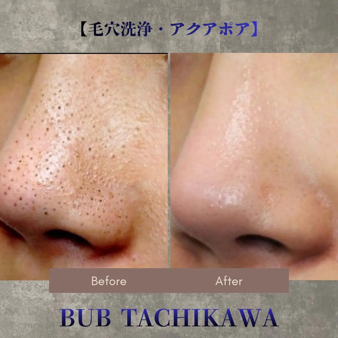 メンズ 【BUB立川】 ゆかのエステ・リラクイメージ