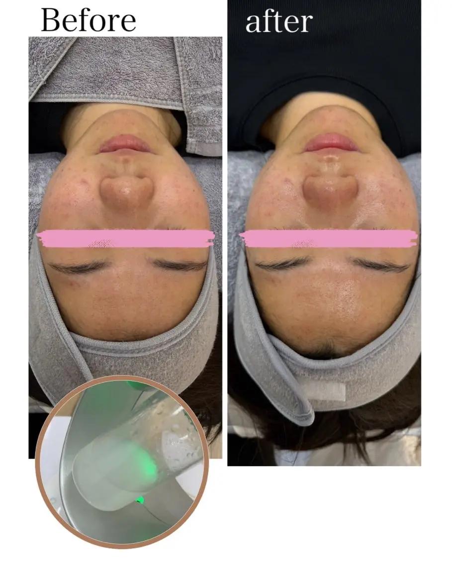 salon merci和泉のエステ・リラクイメージ