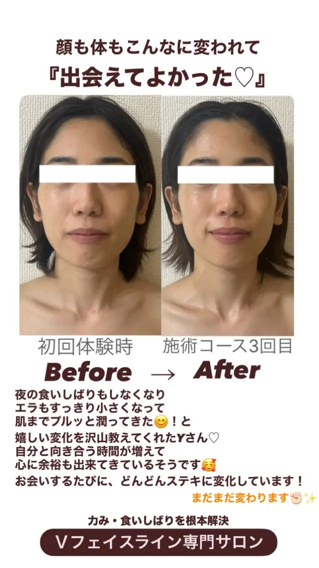 小顔サロン (ラ リュミエール)のエステ・リラクイメージ