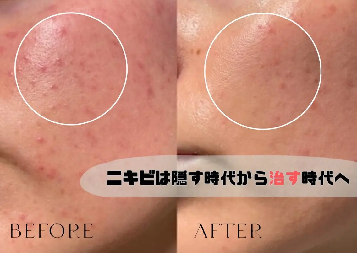 肌質改善サロン réposのその他イメージ
