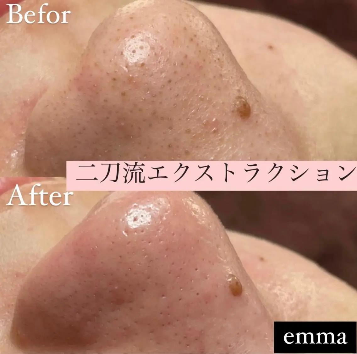 プライベートサロン emma【エマ】の眉毛・アイブロウイメージ