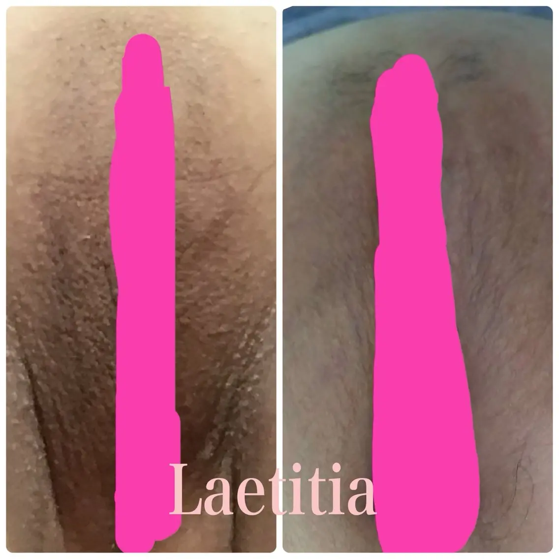 レティティア （Laetitia）のエステ・リラクイメージ