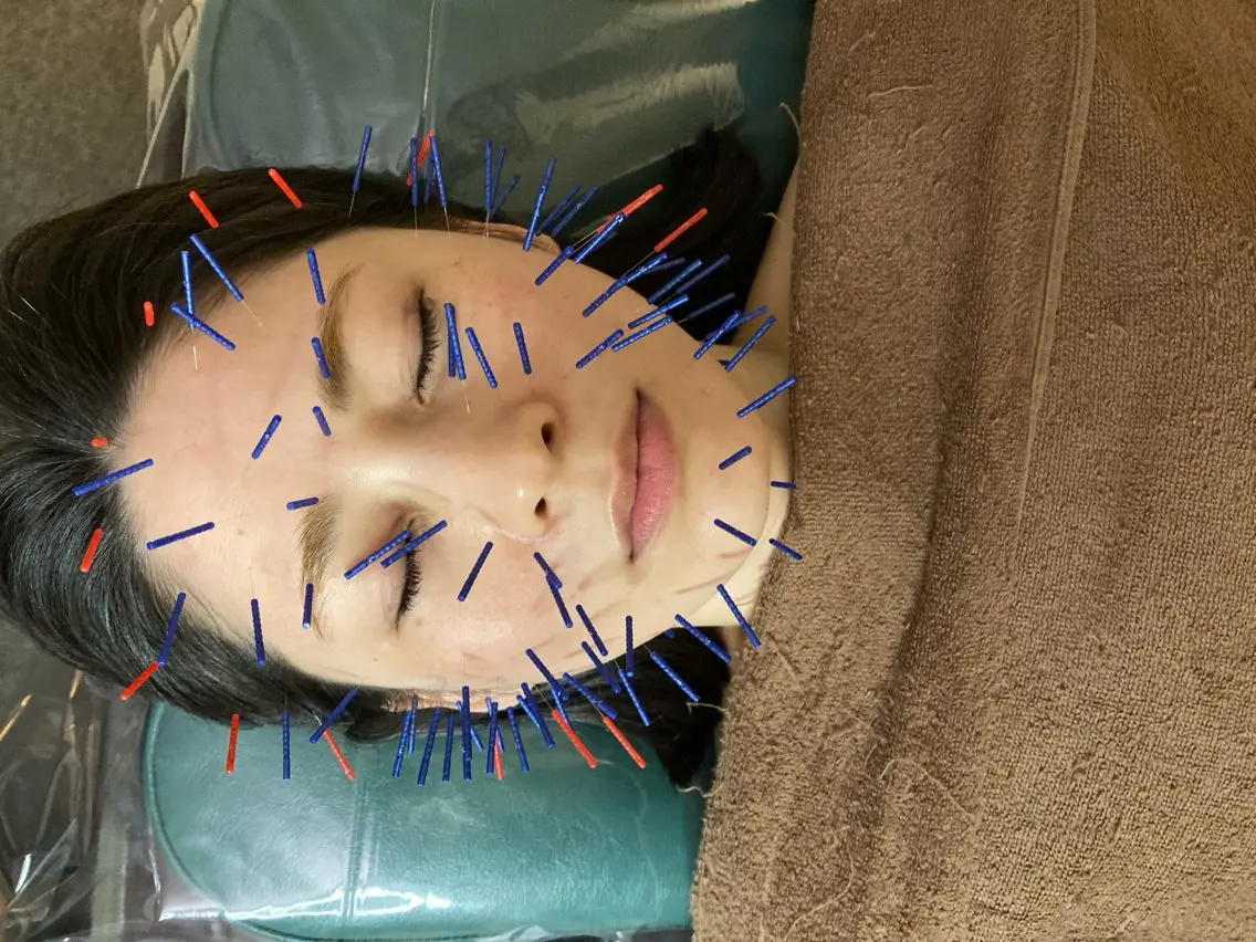 美容鍼灸整体院 Cure&Belleのエステ・リラクイメージ
