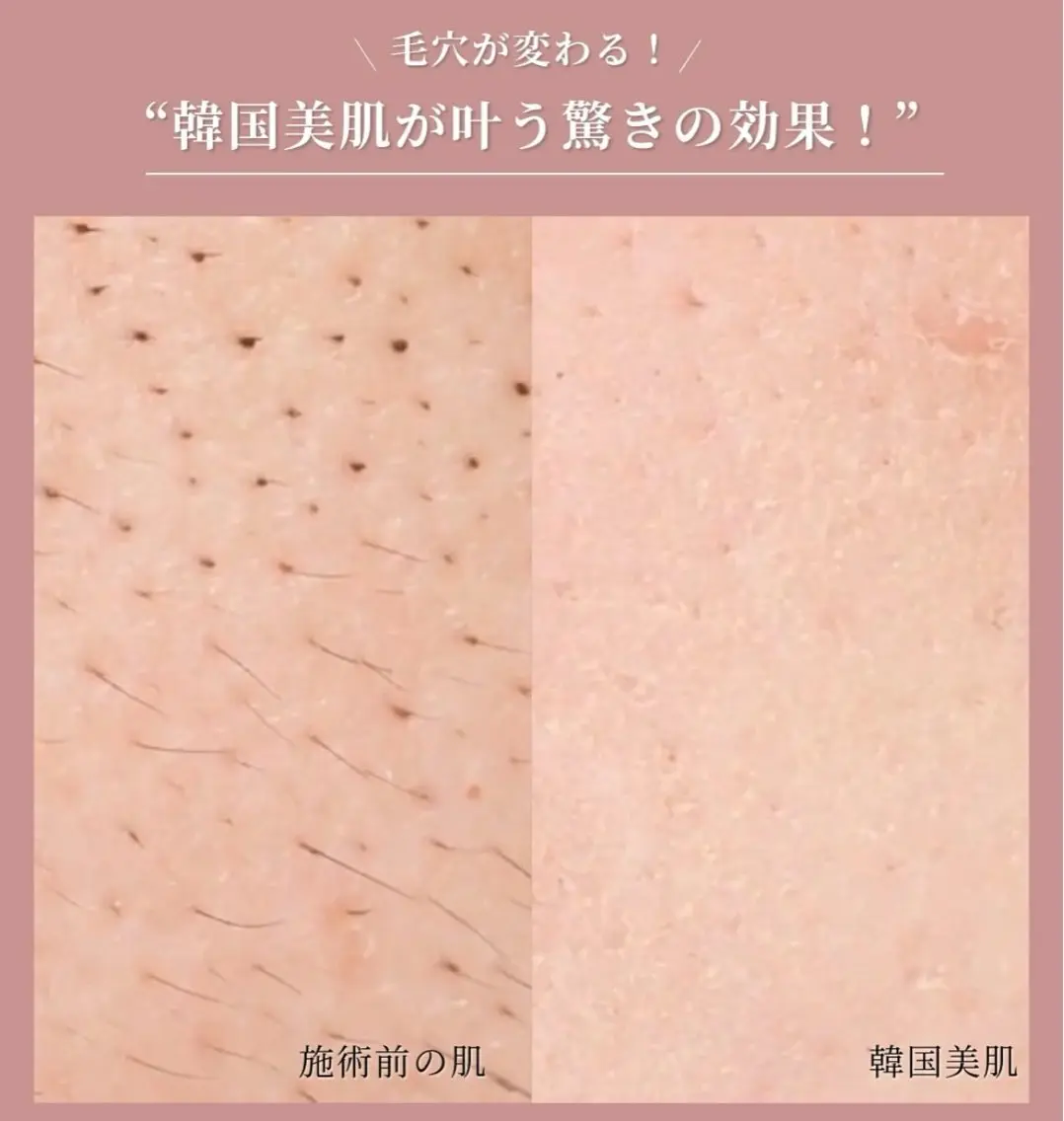 毛穴肌管理サロン ラクシュミーのエステ・リラクイメージ