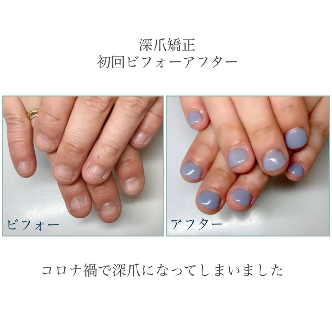 ネイル ネイルサロン アリュームのネイルデザイン
